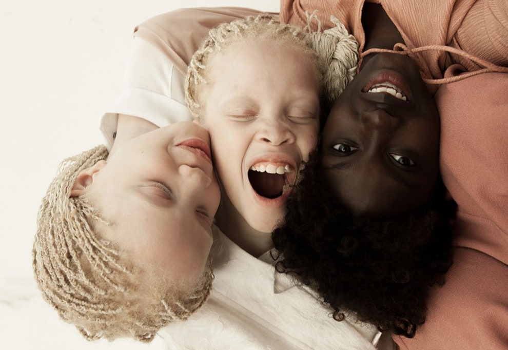Сестры Бавар близнецыальбиносы Лара и Мара и темнокожая Шейла на фото Виничиуса Террановы | Vogue